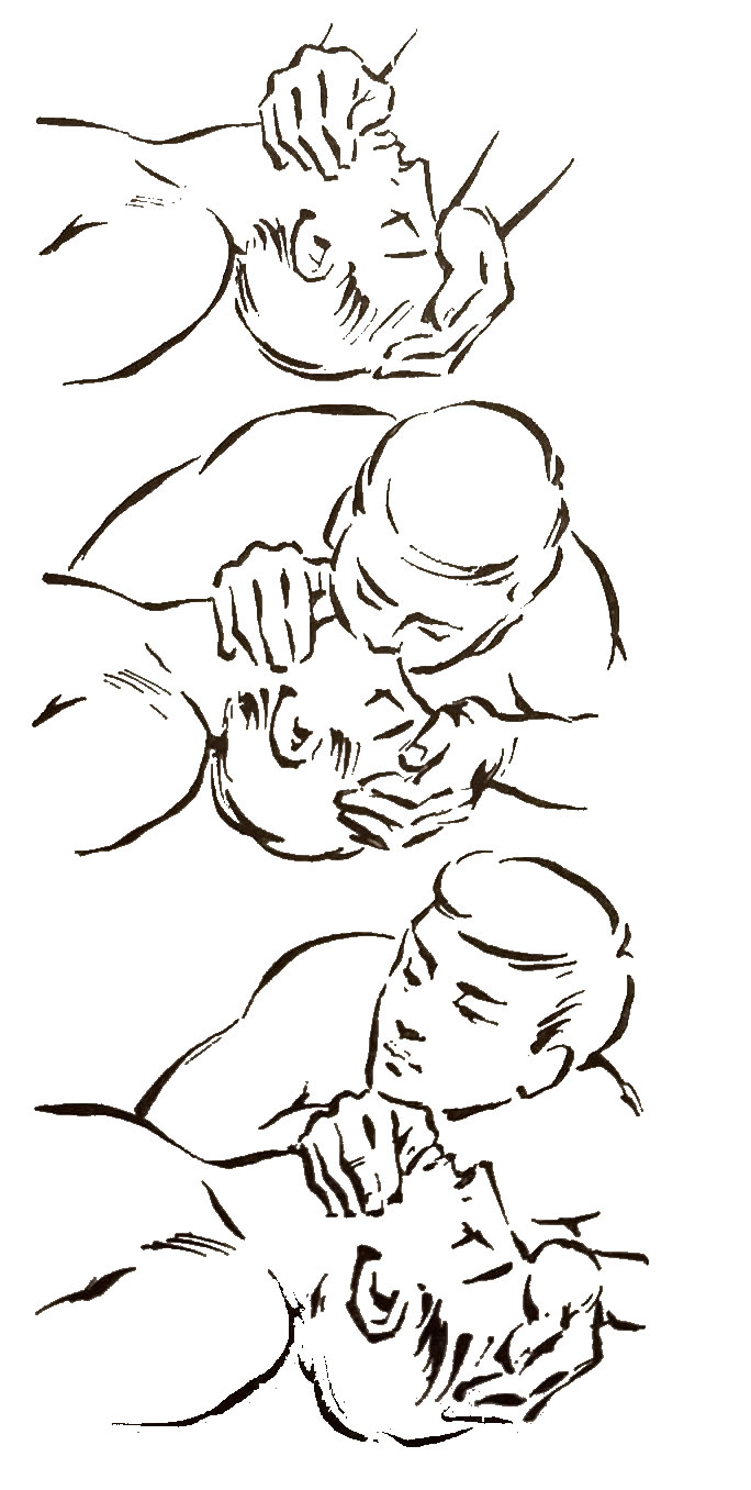 reanimatieprocedures
